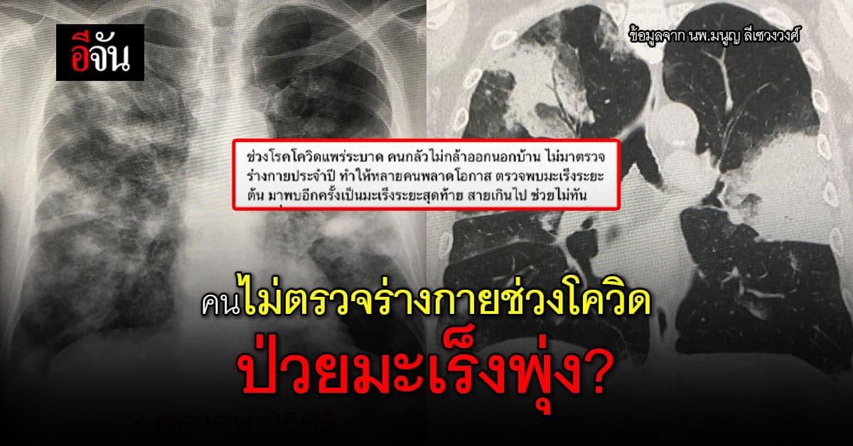 นพ.มนูญ ยกเคสช่วง โควิด พบคนป่วย มะเร็ง เพิ่มขึ้น