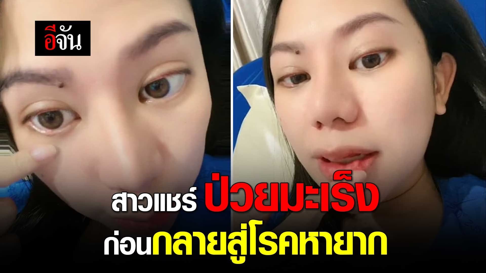 🎬 สาวแชร์ ป่วยมะเร็ง ก่อนกลายสู่โรคหายาก