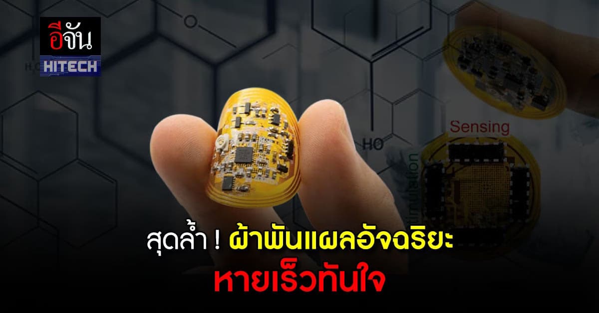 สุดล้ำ ! ต้นแบบผ้าพันแผลอัจฉริยะ ตัวช่วยเร่งการรักษาแผลให้หายเร็วขึ้น