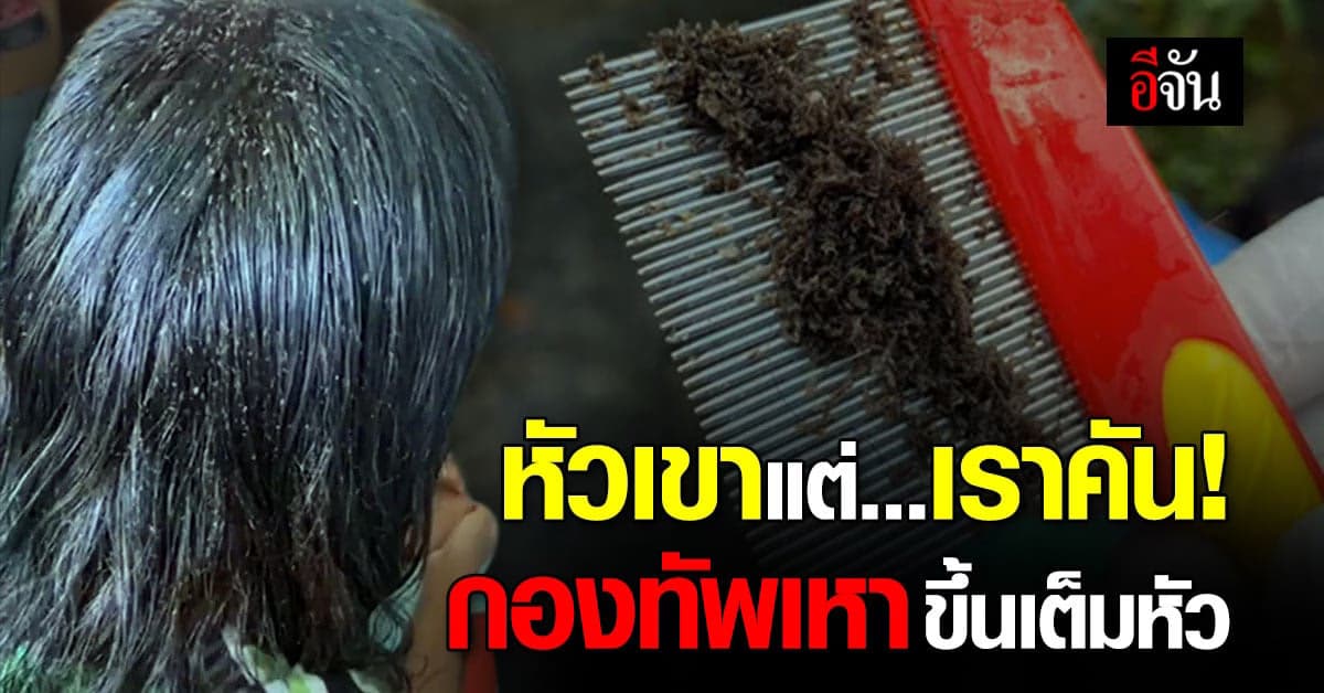 สยองมาก หัวเขาแต่เราคัน กองทัพเหาขึ้นหัวเด็กหญิงเดินยั้วเยี้ย