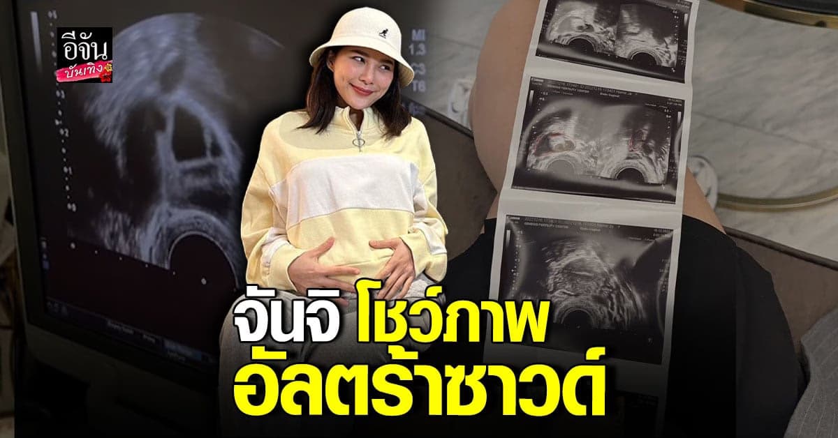 จันจิ จันจิรา โชว์ภาพอัลตร้าซาวด์ ของขวัญปีใหม่