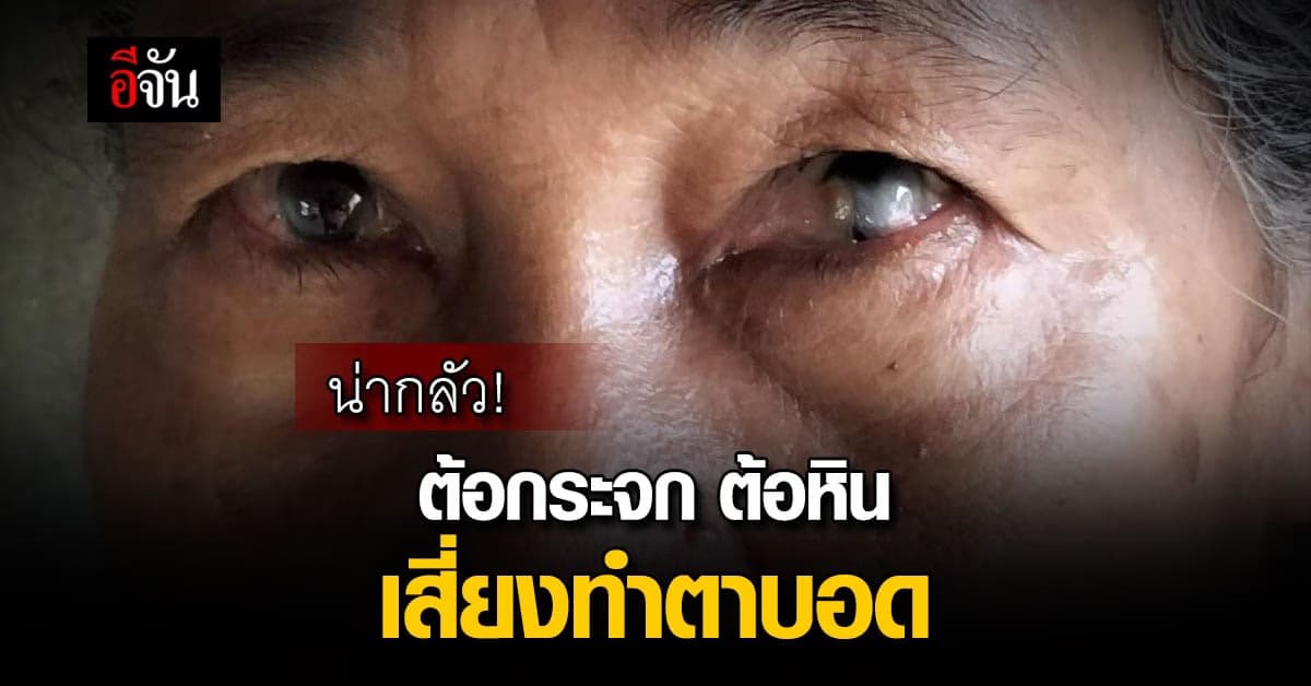 เรื่องตาเรื่องใหญ่! ต้อกระจก ต้อหิน เสี่ยงตาบอด