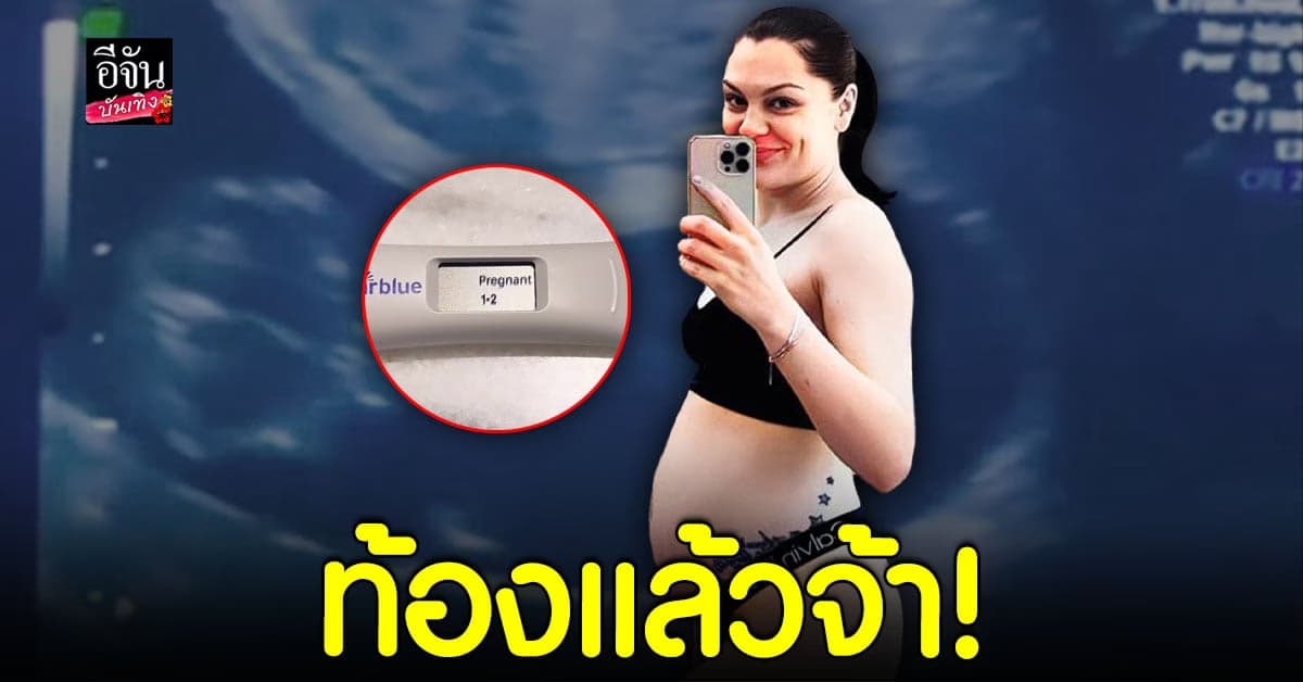 เจสซี่ เจ ( Jessie J ) ประกาศข่าวดี ตั้งครรภ์อีกครั้ง หลังเคยแท้ง!