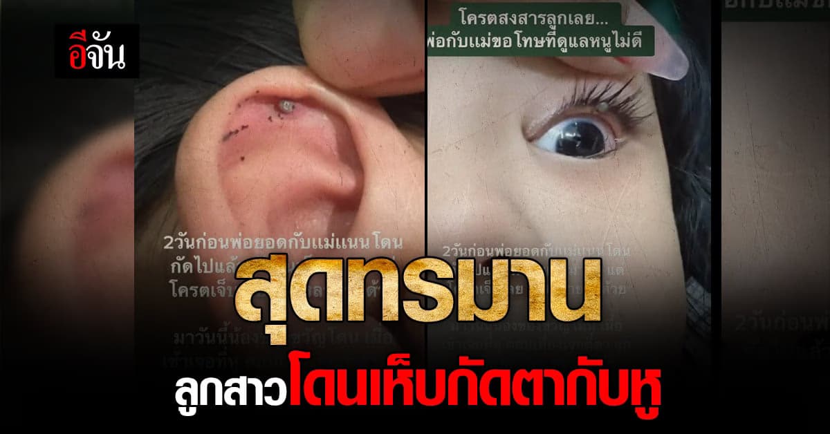 สุดทรมาน ลูกสาวโดนเห็บกัด ที่หู กับที่ตา พ่อแม่ไม่รู้