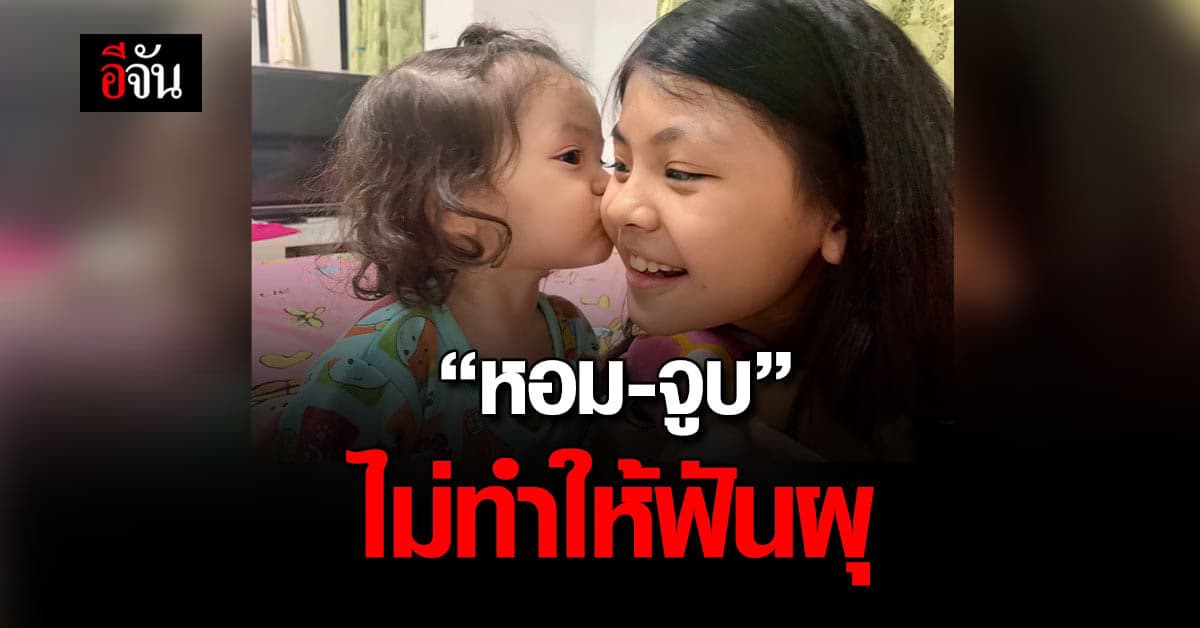 ชัวร์แล้ว! หอมหรือจูบไม่ทำให้ฟันผุ