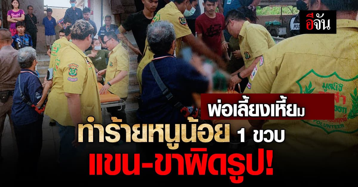 พ่อเลี้ยงทำร้ายลูกเลี้ยงสาหัส แขน-ขาผิดรูป!