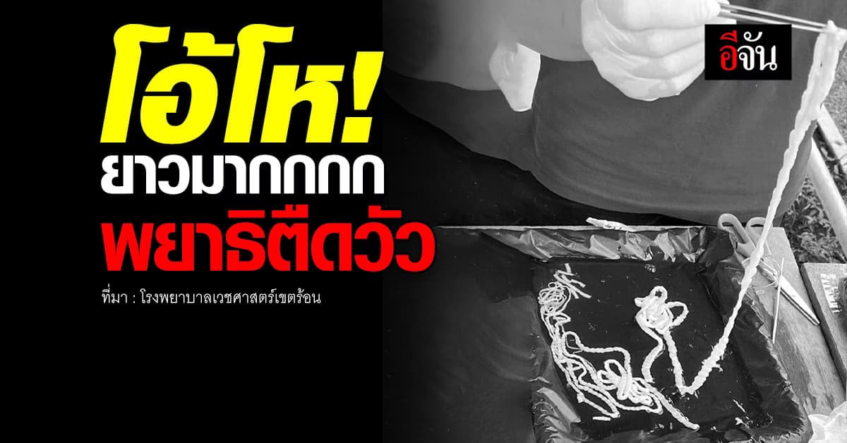 โคตรยาว! พยาธิตืดวัว สายซอยจุ๊เนื้อดิบต้องระวัง