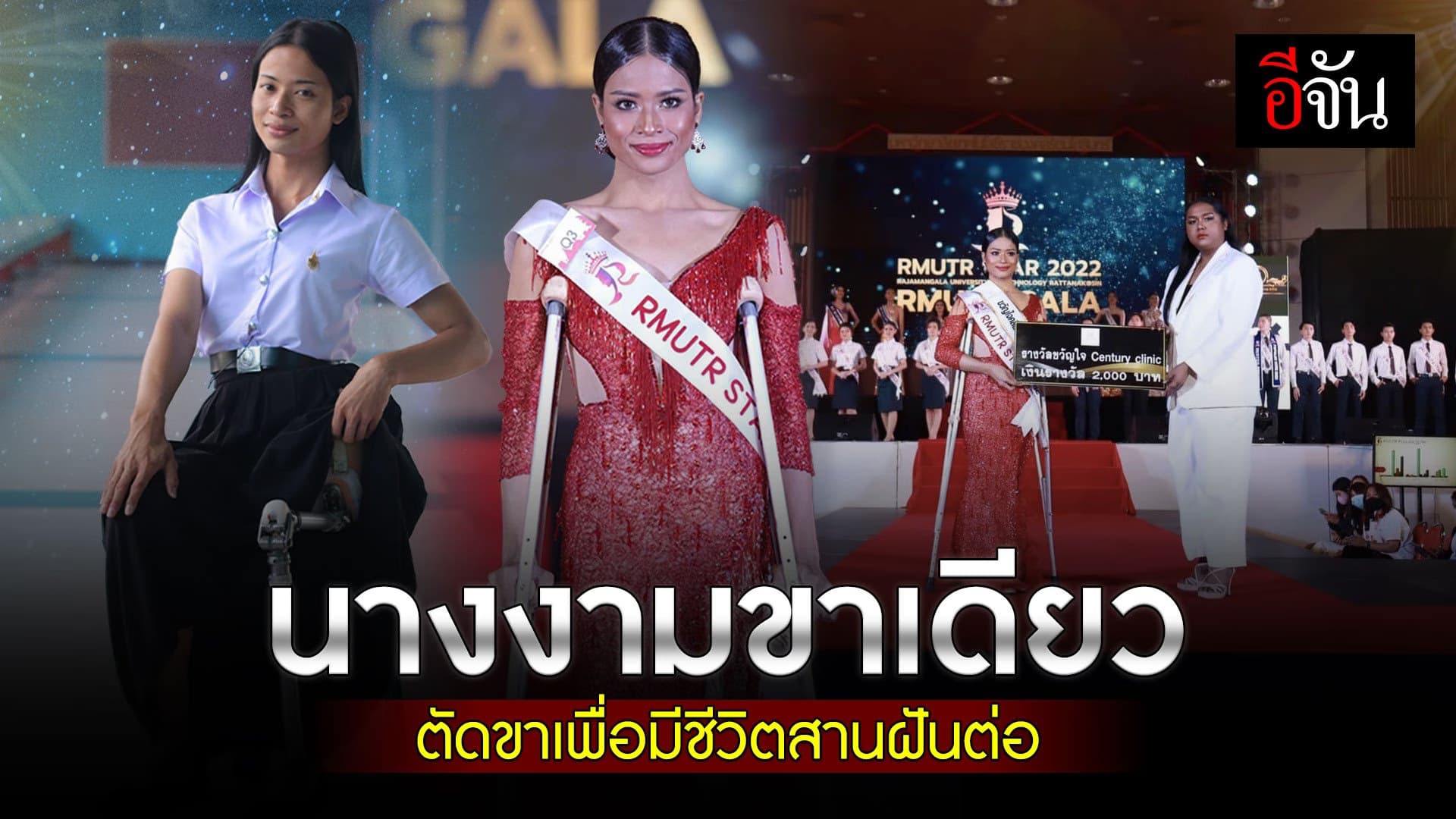 🎬 นางงามขาเดียว ตัดขาเพื่อมีชีวิตสานฝันต่อ