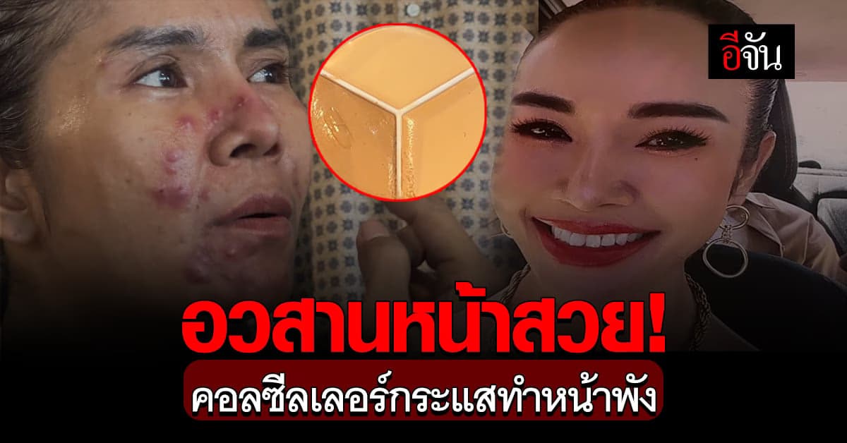 อวสานหน้าสวย! แม่ค้าออนไลน์สั่งคอลซีลเลอร์ตามกระแส สุดท้ายหน้าพัง