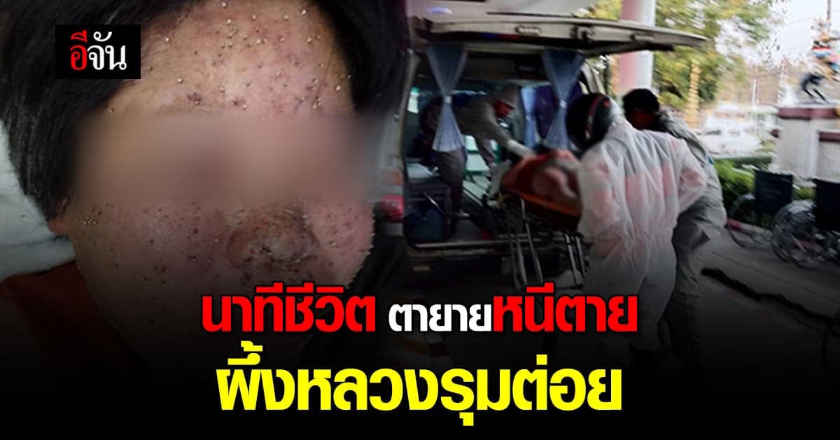 ผึ้งหลวง รุมต่อย 2 ตายาย หนีตายสุดชีวิต !