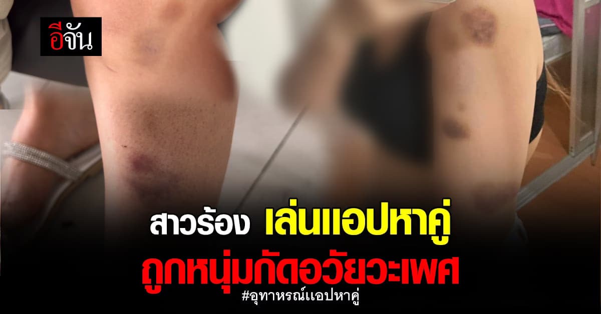 สาว 28 ร้อง เล่นเเอพหาคู่ เจอหนุ่ม 22 ทุบตี กัดอวัยวะเพศ