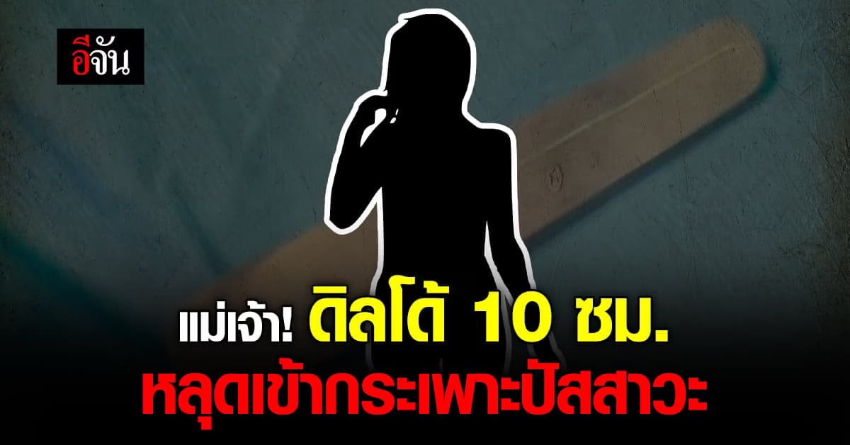 สาวอิสราเอล พลาด ใส่ ดิลโด้ ผิดที่ หลุดเข้า กระเพาะปัสสาวะ