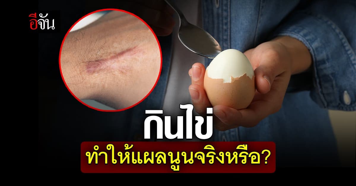 กินไข่ทำให้แผลนูนจริงหรือ?