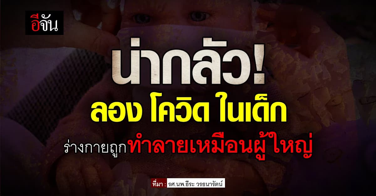 อึ้ง! เด็กติดโควิด ร่างกายมีอาการผิดปกตินาน 1 ปี