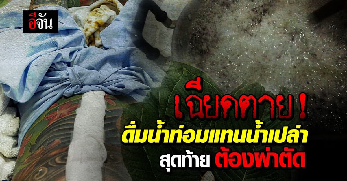 อุทาหรณ์เฉียดตาย ดื่มน้ำท่อมแทนน้ำเปล่า สุดท้ายต้องผ่าตัดด่วน