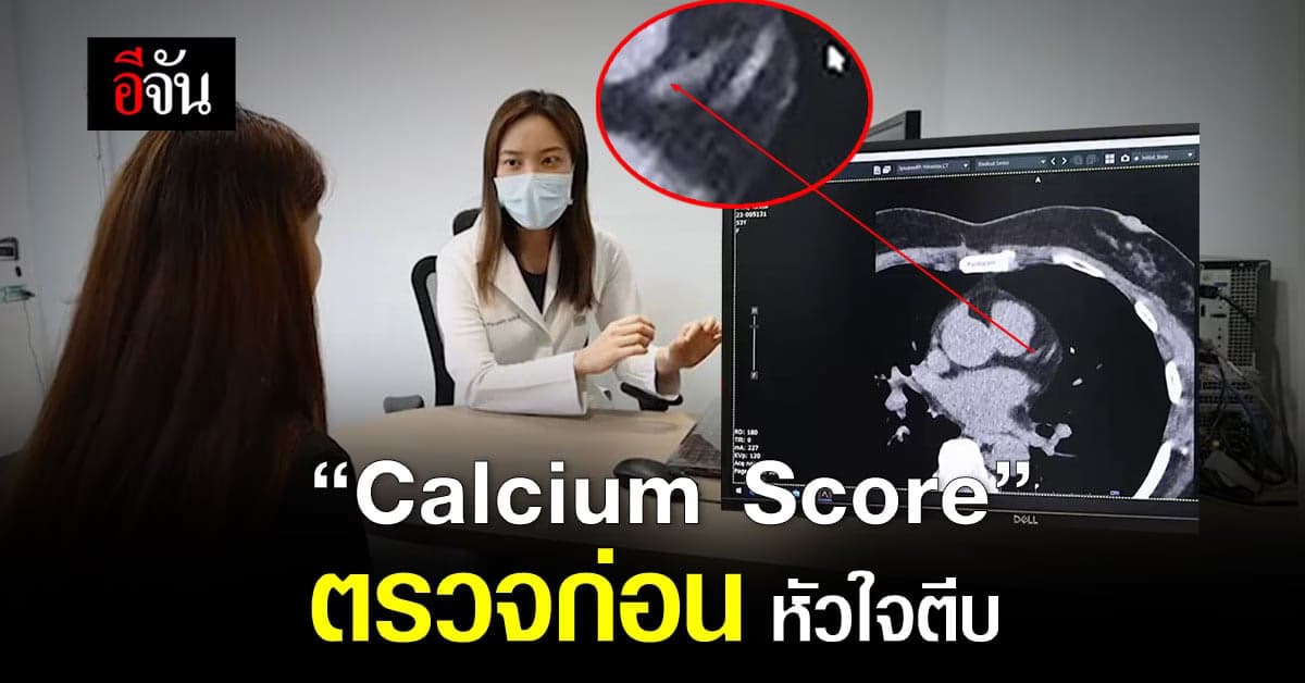 แคลเซียมในหลอดเลือดหัวใจ ตรวจก่อน หัวใจตีบ