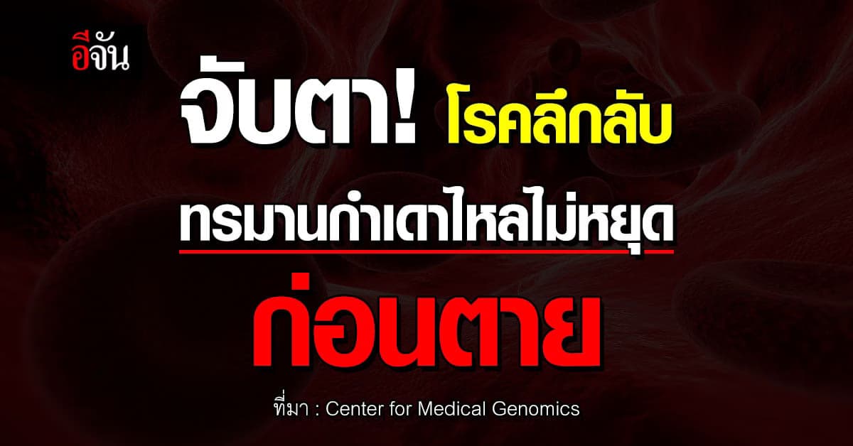 จับตา! โรคลึกลับ ใน “บุรุนดี” ตาย 3 คนภายใน 24 ชั่วโมง กำเดาไหลไม่หยุด