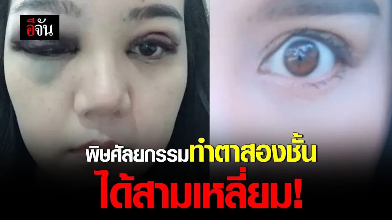 🎬 พิษศัลยกรรม ทำตาสองชั้น ได้สามเหลี่ยม!