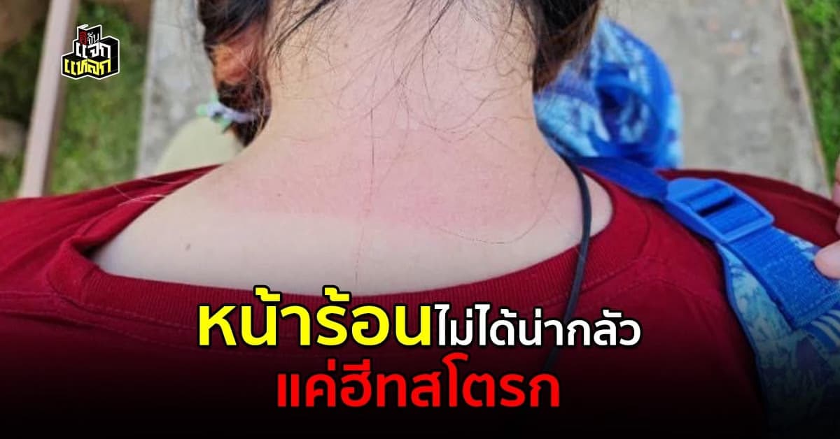 เปิด 5 โรคที่มากับหน้าร้อน อย่าระวังเเค่ฮีทสโตรก