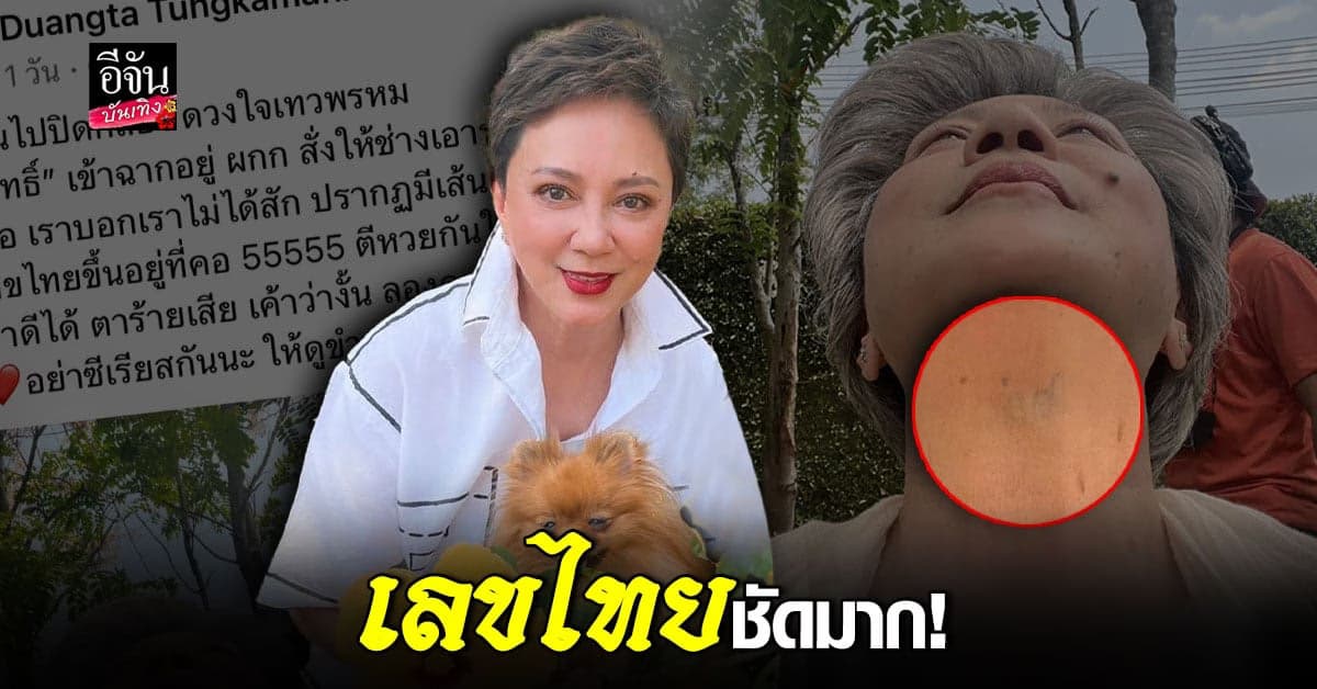 ตุ๊ก ดวงตา แชร์ เรื่องแปลก เมื่อเส้นเลือดขอดขึ้นเป็นตัวเลข