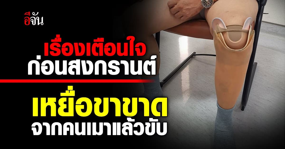 หดหู่ใจ หมอเล่า คนไข้เป็นเหยื่อขาขาด โดนคนเมาแล้วขับชน