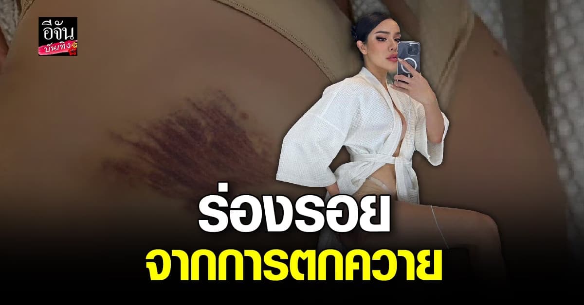 นัท นิสามณี เผยรอยช้ำจากการตกควาย ยังโชคดีไม่โดนน้องขวิด