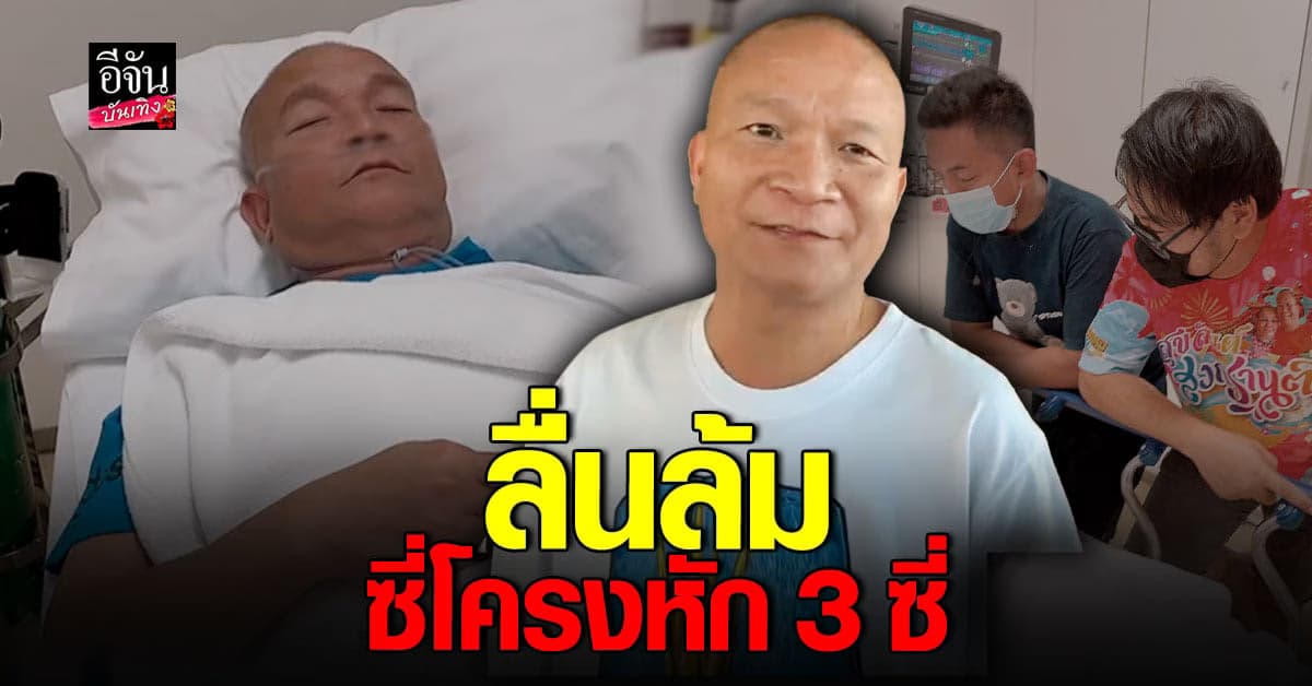 ​หม่ำ จ๊กมก ประสบอุบัติเหตุ ลื่นล้ม ซี่โครงหัก 3 ซี่