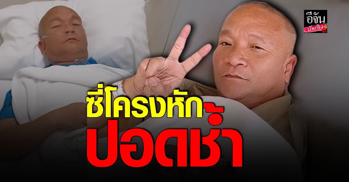 ​หม่ำ จ๊กมก เปิดใจ ตอนนี้ยังเจ็บนิดหน่อย พรุ่งนี้เตรียมเอกซเรย์อีกรอบ