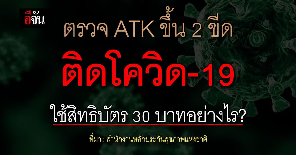 ติดโควิด-19 ใช้สิทธิบัตร 30 บาทอย่างไร?