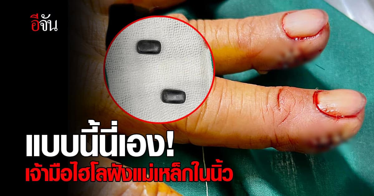 เปิดกลโกง เจ้ามือไฮโล ฝังแม่เหล็กไว้ในนิ้ว ควบคุมลูกเต๋า