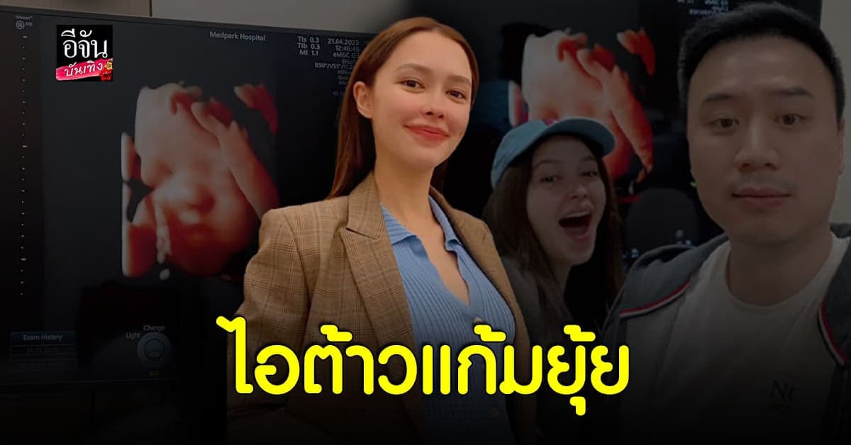 แพทริเซีย อวดภาพอัลตร้าซาวด์ ลูกสาว ฉายแววน่ารัก