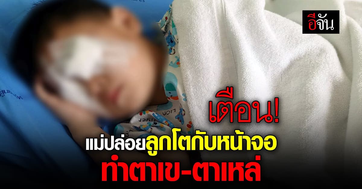 เตือน! แม่ปล่อยลูกอยู่กับจอส่งผลภาวะตาเขร่วมตาเหล่ ค่ารักษาร่วมแสน
