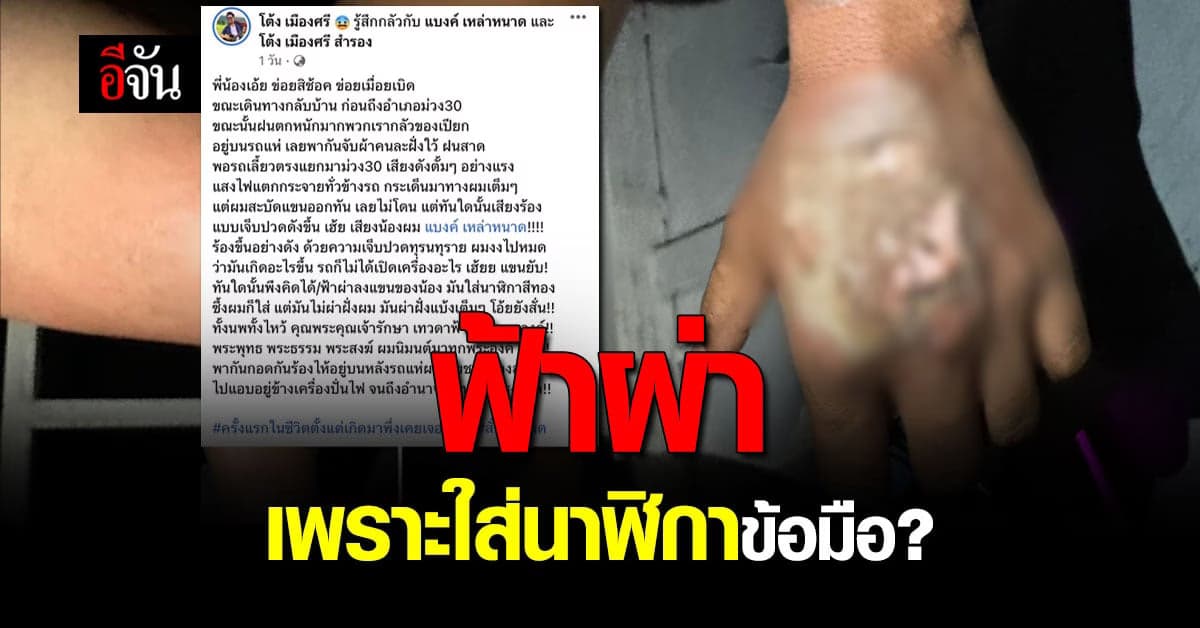 หนุ่มโพสต์ เกิดมาเพิ่งเคยเจอ ฟ้าผ่า เพราะใส่นาฬิกาข้อมือ