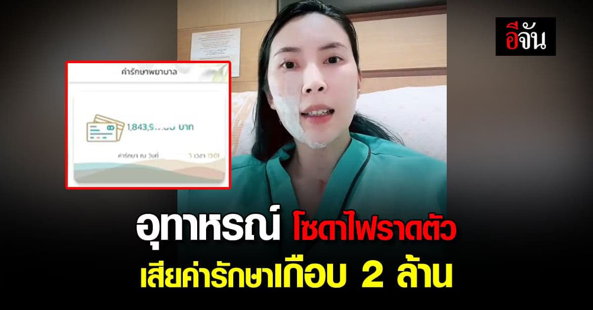 สาวแชร์อุทาหรณ์ ถูกโซดาไฟราดตัว เป็นแผลพุพองเต็มตัว