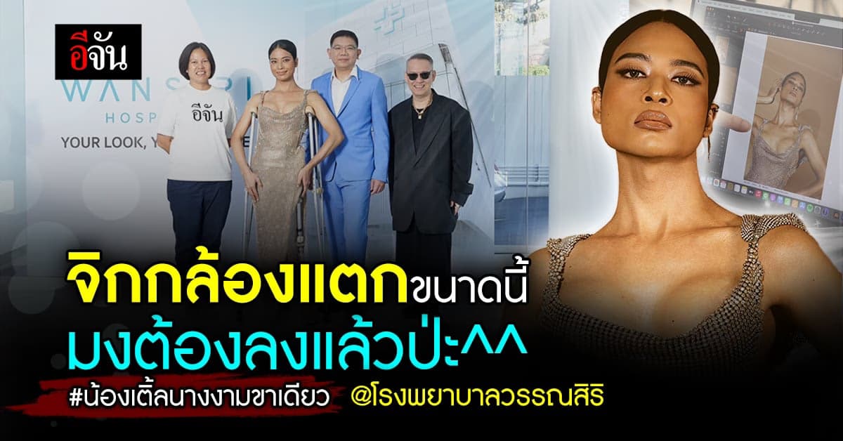 แปลงโฉม น้องเติ้ล นางงามขาเดียว อวดอกใหม่ ที่ โรงพยาบาลวรรณสิริ