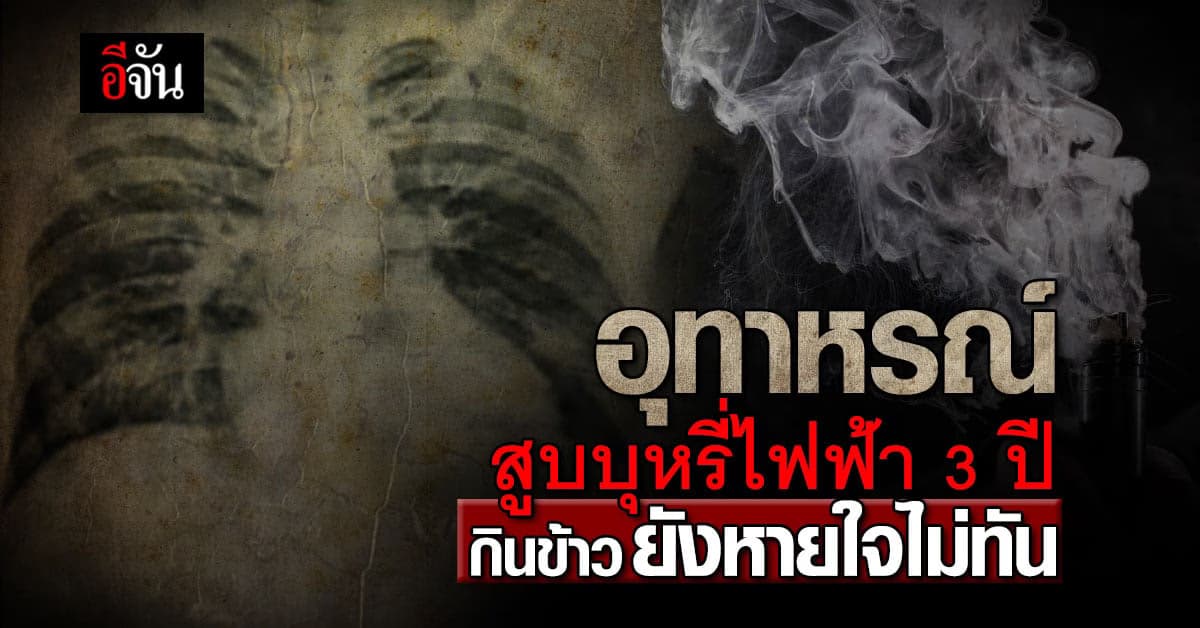 อุทาหรณ์ ผลของการสูบบุหรี่ไฟฟ้า 3 ปีเต็ม แค่กินข้าวยังหายใจไม่ทัน