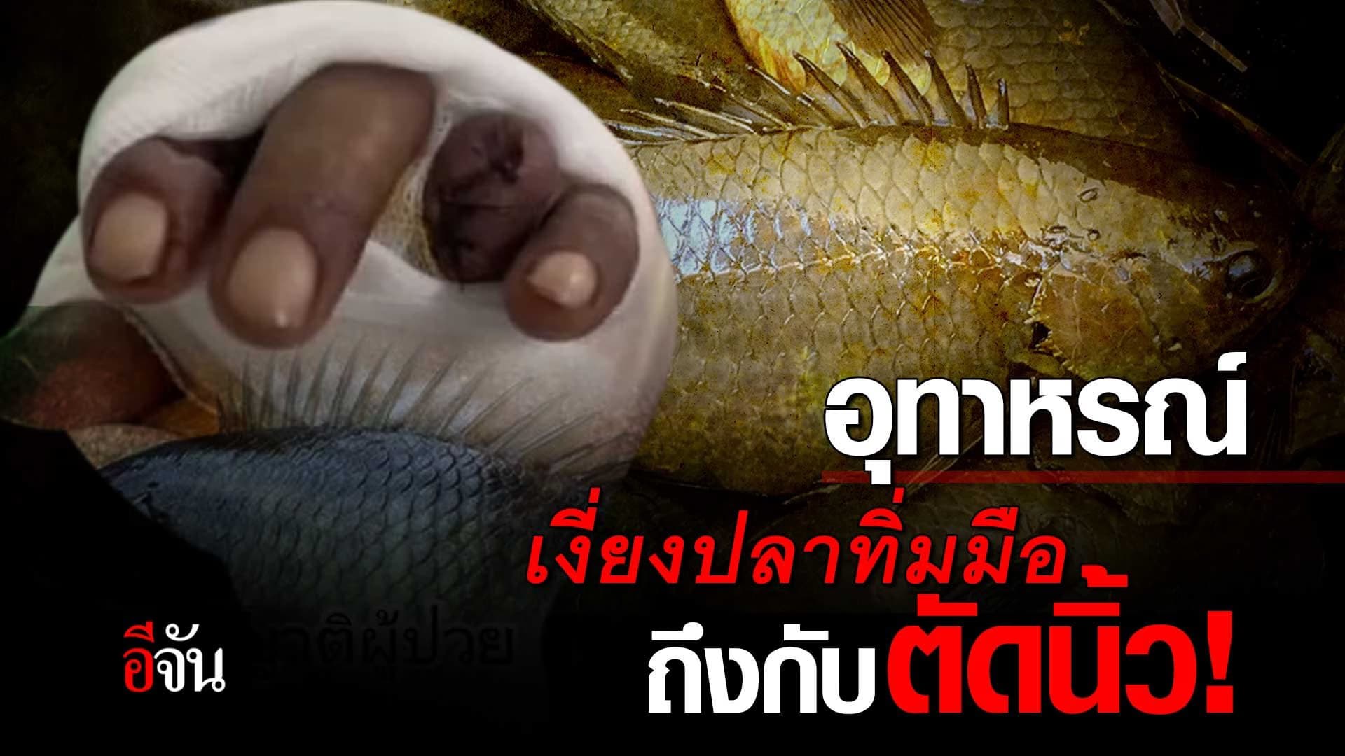 🎬 อุทาหรณ์ เงี่ยงปลาทิ่มมือ ถึงกับตัดนิ้ว!