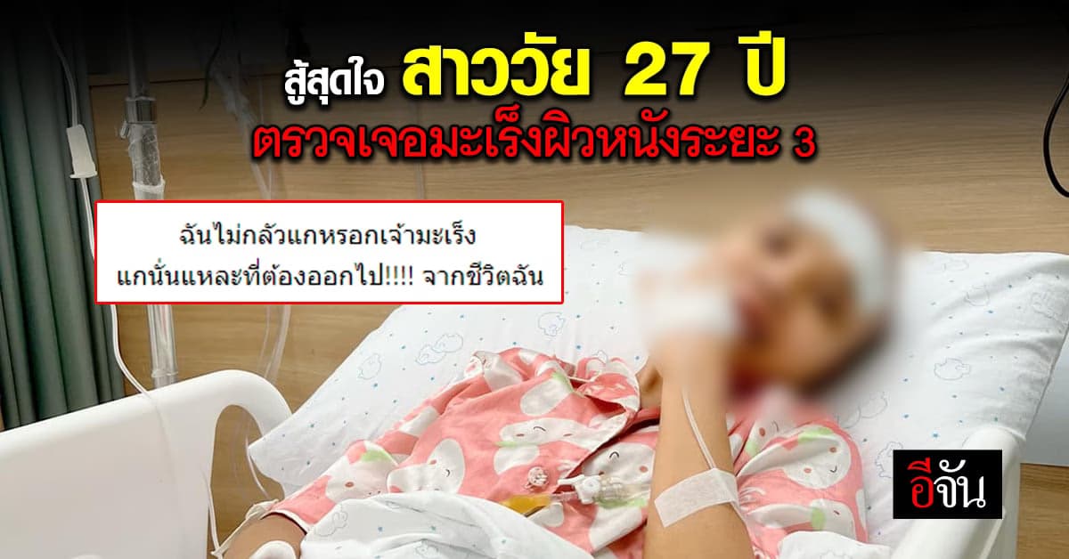 สาวแชร์ประสบการณ์ จากโรคสะเก็ดเงิน สู่มะเร็งผิวหนังในวัย 27 ปี