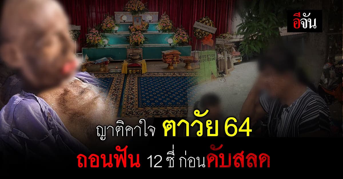 คุณตาวัย 64 ดับ หลัง ถอนฟัน 12 ซี่ ใน 2 วัน ญาติคาใจ ไม่เคยเจอแบบนี้