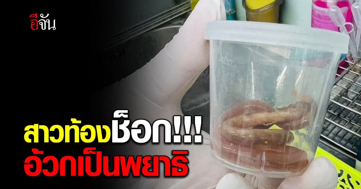 สาวท้อง 8 เดือน อ้วกเป็นพยาธิ ตัวโต 15 เซนติเมตร