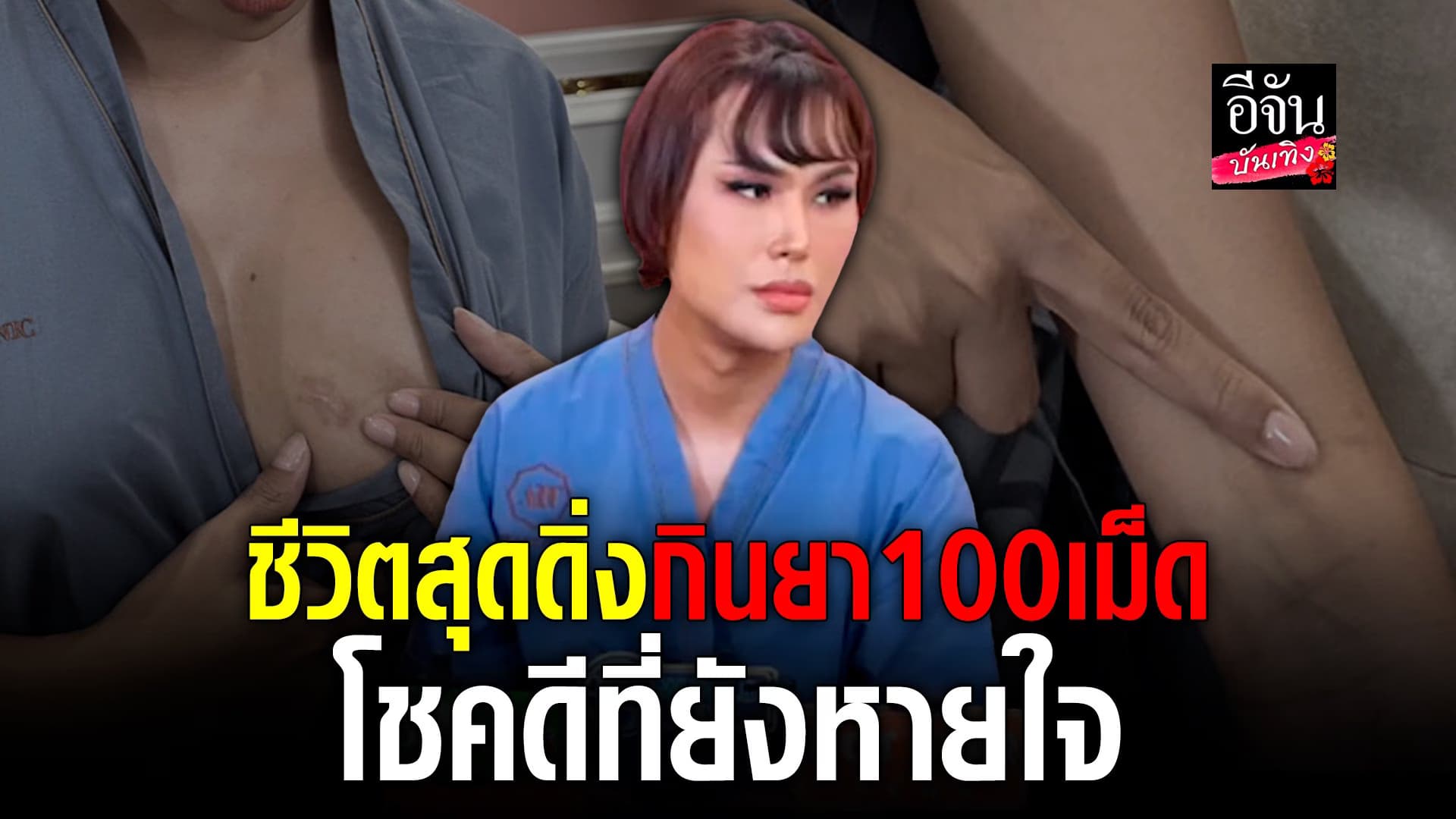 🎬 คลิปบันเทิง : แอนนา รับเคยคิดฆ่าตัวตาย เพราะหยุดยาซึมเศร้า