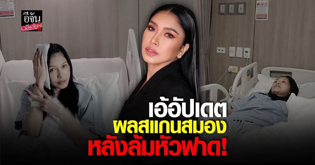 เอ้ ชุติมา อัปเดตอาการหลัง ล้มหัวฟาดชักโครก!