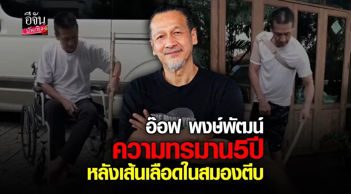 อ๊อฟ พงษ์พัฒน์ ทรมานนานกว่า 5 ปี หลัง เส้นเลือดในสมองตีบ