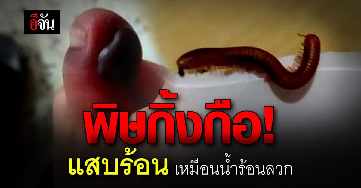 เตือนภัยหน้าฝน! ระวังกิ้งกือ พิษร้ายถูกตัวเหมือนแสบเหมือนน้ำร้อนลวก