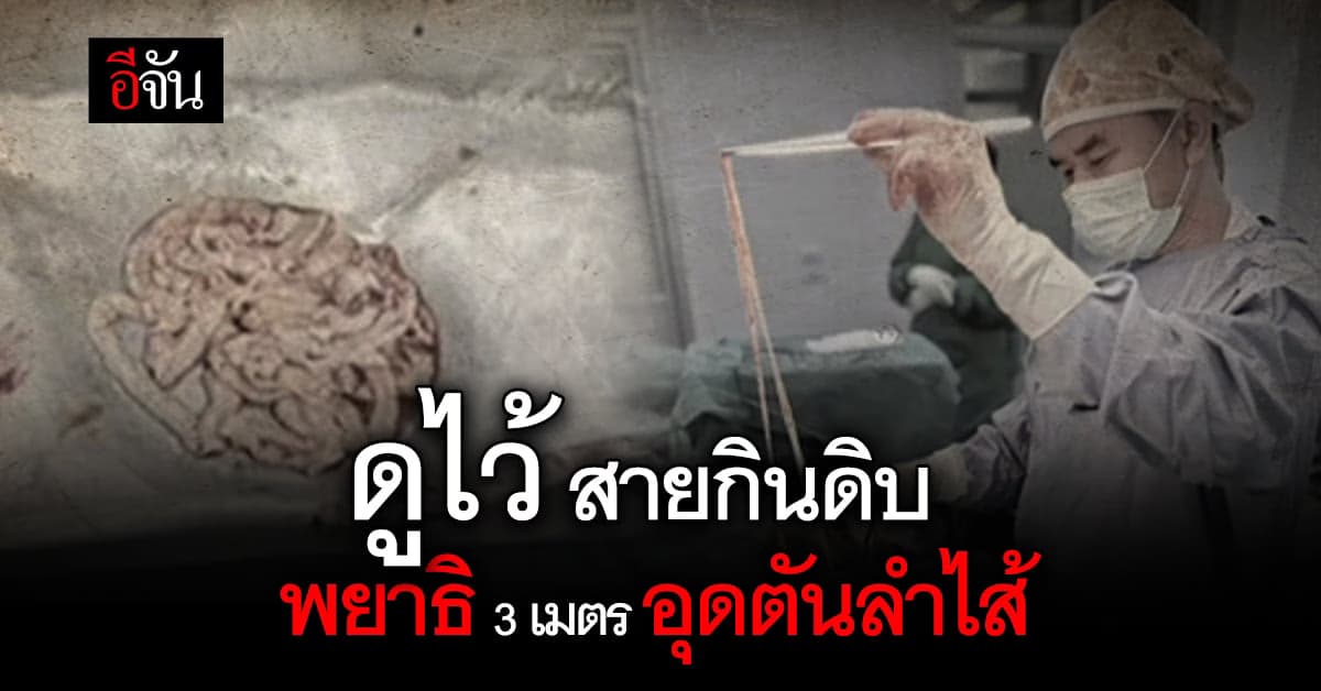 ขนลุก พยาธิตัวตืด 3 เมตร ทำลำไส้อุดตัน