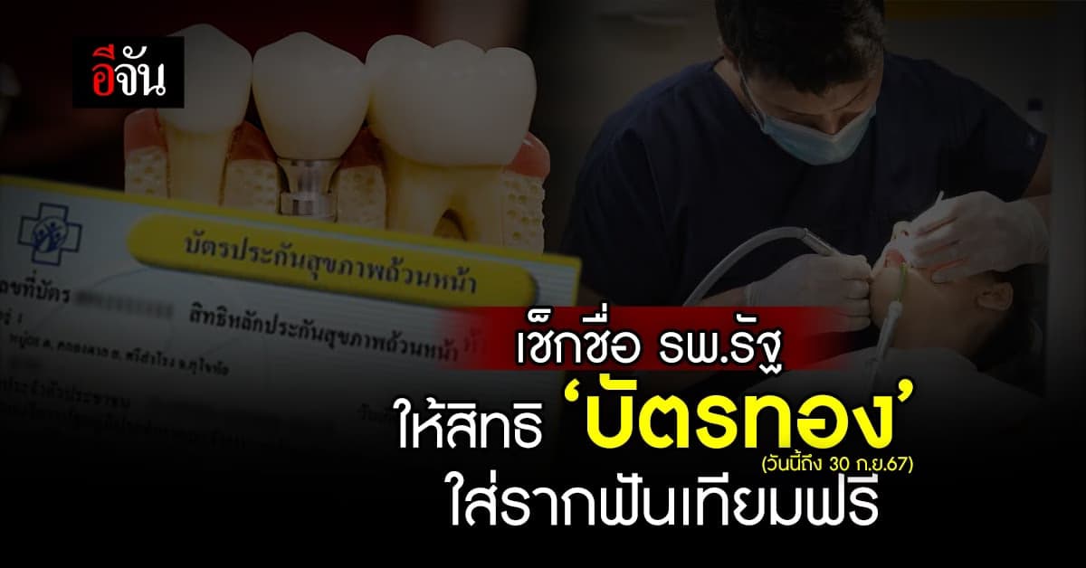 สิทธิบัตรทอง ใส่รากฟันเทียมฟรี ที่โรงพยาบาลรัฐ วันนี้ถึง 30 ก.ย.67