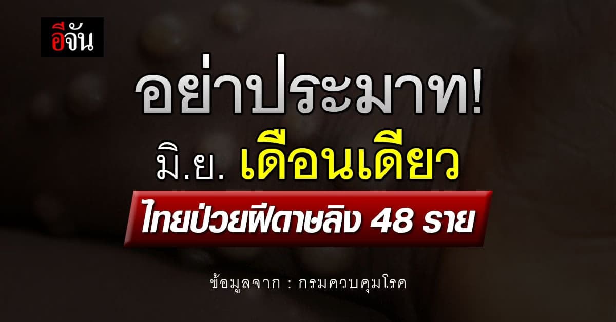 อึ้ง! มิ.ย.เดือนเดียว ไทยป่วยฝีดาษลิง 48 ราย