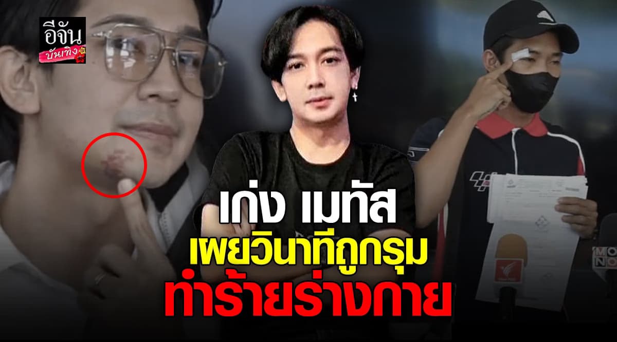 เก่ง เมทัส เผยวินาทีถูกเจ้าหนี้ของลูกน้องทำร้ายร่างกาย