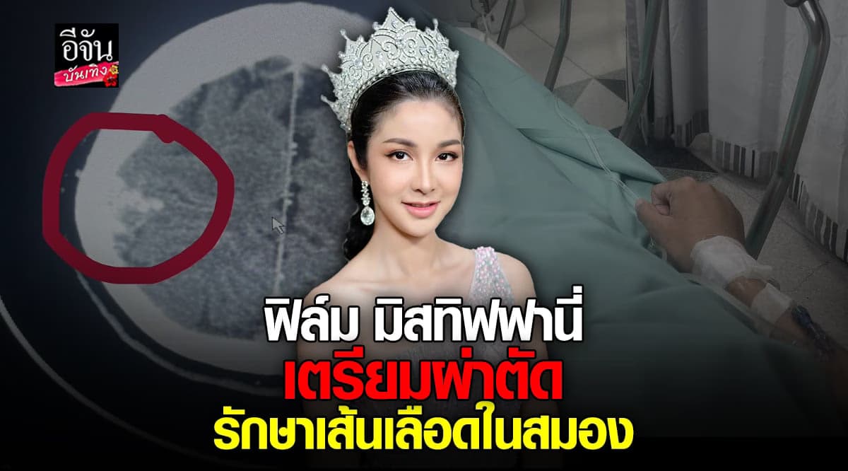 ฟิล์ม มิสทิฟฟานี่ ป่วย เส้นเลือดในสมองบวม เตรียมเข้ารับการผ่าตัด
