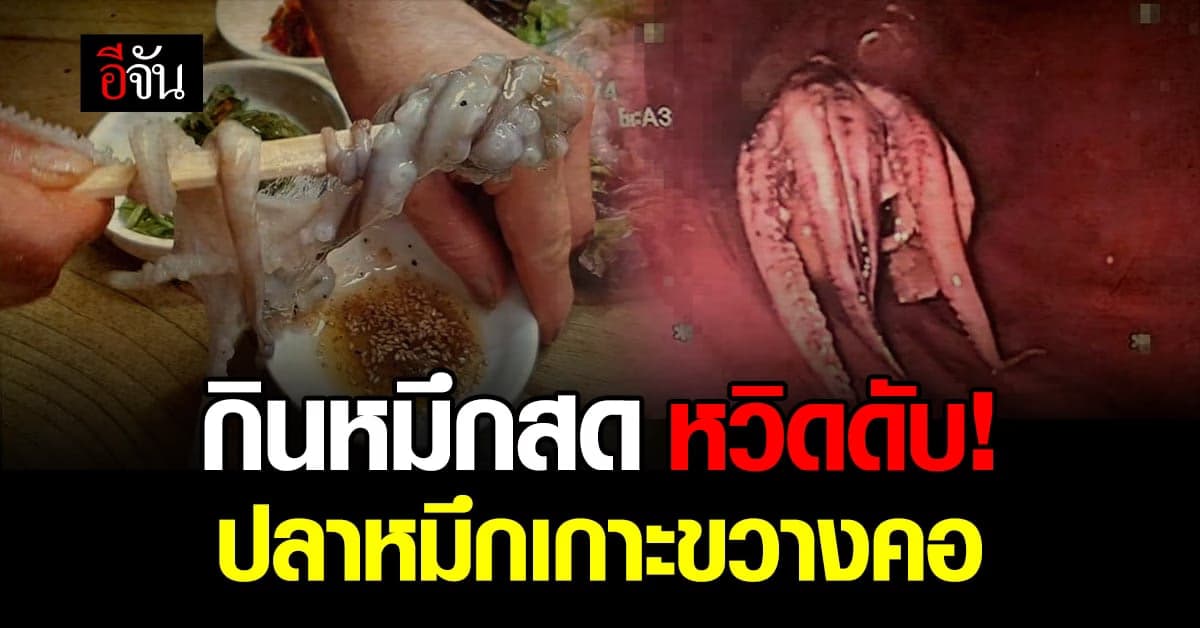 หวิดดับ! ปลาหมึกเกาะขวางคอ จนต้องผ่าตัด
